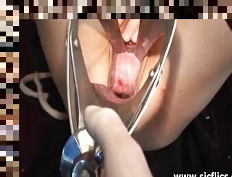 Bizarre vaginal gaping with XXL horse speculum